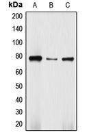 Western blot analysis of DBF4 expression in Jurkat (A); HepG2 (B); SW480 (C) whole cell lysates.