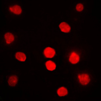 Immunofluorescent analysis of DBF4 staining in HepG2 cells. Formalin-fixed cells were permeabilized with 0.1% Triton X-100 in TBS for 5-10 minutes and blocked with 3% BSA-PBS for 30 minutes at room temperature. Cells were probed with the primary antibody in 3% BSA-PBS and incubated overnight at 4 C in a humidified chamber. Cells were washed with PBST and incubated with a DyLight 594-conjugated secondary antibody (red) in PBS at room temperature in the dark. DAPI was used to stain the cell nuclei (blue).