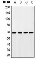 Western blot analysis of GPR75 expression in HEK293T (A); A549 (B); SP2/0 (C); rat kidney (D) whole cell lysates.