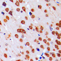 Immunohistochemical analysis of JAB1 staining in human brain formalin fixed paraffin embedded tissue section. The section was pre-treated using heat mediated antigen retrieval with sodium citrate buffer (pH 6.0). The section was then incubated with the antibody at room temperature and detected using an HRP conjugated compact polymer system. DAB was used as the chromogen. The section was then counterstained with haematoxylin and mounted with DPX.