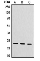 Western blot analysis of CYB561D2 expression in HeLa (A); mouse liver (B); rat kidney (C) whole cell lysates.