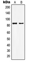 Western blot analysis of KAT7 expression in HepG2 (A); MCF7 (B) whole cell lysates.