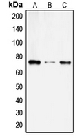 Western blot analysis of SLC6A14 expression in SKNMC (A); COLO205 (B); HL60 (C) whole cell lysates.