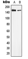 Western blot analysis of LMTK2 expression in HeLa (A); HEK293T (B) whole cell lysates.