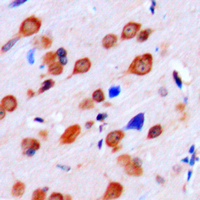 Immunohistochemical analysis of LMTK2 staining in human brain formalin fixed paraffin embedded tissue section. The section was pre-treated using heat mediated antigen retrieval with sodium citrate buffer (pH 6.0). The section was then incubated with the antibody at room temperature and detected using an HRP conjugated compact polymer system. DAB was used as the chromogen. The section was then counterstained with haematoxylin and mounted with DPX.