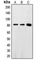 Western blot analysis of FASTKD2 expression in HeLa (A); Jurkat (B); Ramos (C) whole cell lysates.