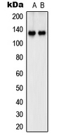 Western blot analysis of SHANK2 expression in Jurkat (A); IMR32 (B) whole cell lysates.