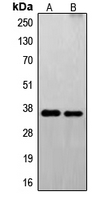 Western blot analysis of FAIM2 expression in U251 (A); EL4 (B) whole cell lysates.