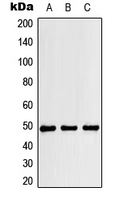Western blot analysis of RBM34 expression in HeLa (A); mouse liver (B); H9C2 (C) whole cell lysates.