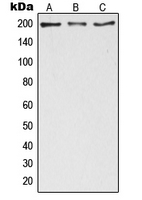Western blot analysis of ZC3H13 expression in HeLa (A); NIH3T3 (B); PC12 (C) whole cell lysates.