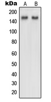 Western blot analysis of NUP160 expression in HeLa (A); NIH3T3 (B) whole cell lysates.