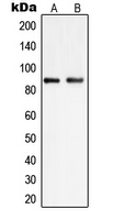 Western blot analysis of PIP5K1C expression in HEK293 (A); K562 (B) whole cell lysates.