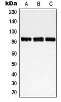 Western blot analysis of NCAPH expression in HeLa (A); Jurkat (B); MOLT4 (C) whole cell lysates.