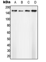 Western blot analysis of SAP155 expression in A431 (A); Ramos (B); SP2/0 (C); H9C2 (D) whole cell lysates.