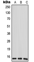 Western blot analysis of ANP32D expression in HeLa (A); mouse liver (B); rat liver (C) whole cell lysates.