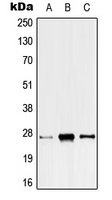 Western blot analysis of ANP32C expression in HeLa (A); SP2/0 (B); H9C2 (C) whole cell lysates.