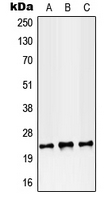 Western blot analysis of RAB38 expression in MCF7 (A); SP2/0 (B); PC12 (C) whole cell lysates.