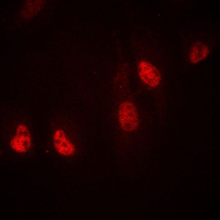 Immunofluorescent analysis of RPL36 staining in MDAMB435 cells. Formalin-fixed cells were permeabilized with 0.1% Triton X-100 in TBS for 5-10 minutes and blocked with 3% BSA-PBS for 30 minutes at room temperature. Cells were probed with the primary antibody in 3% BSA-PBS and incubated overnight at 4 C in a humidified chamber. Cells were washed with PBST and incubated with a DyLight 594-conjugated secondary antibody (red) in PBS at room temperature in the dark. DAPI was used to stain the cell nuclei (blue).