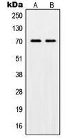 Western blot analysis of POT1 expression in HL60 (A); HeLa (B) whole cell lysates.
