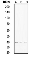Western blot analysis of TIN2 expression in MCF7 (A); HeLa (B); Jurkat (C) whole cell lysates.