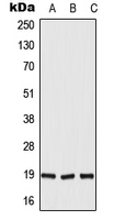 Western blot analysis of DUX5 expression in HepG2 (A); H9C2 (B); rat liver (C) whole cell lysates.