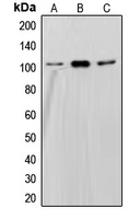 Western blot analysis of SND1 expression in HepG2 (A); Jurkat (B); Ramos (C) whole cell lysates.