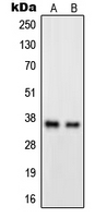 Western blot analysis of GPR82 expression in A549 (A); HeLa (B) whole cell lysates.