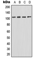 Western blot analysis of HIPK2 expression in HepG2 (A); MCF7 (B); SP2/0 (C); PC12 (D) whole cell lysates.