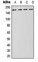 Western blot analysis of DROSHA expression in Jurkat (A); HeLa (B); NIH3T3 (C); PC12 (D) whole cell lysates.