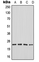 Western blot analysis of SEI-1 expression in MOLT4 (A); Jurkat (B); SP2/0 (C); PC12 (D) whole cell lysates.