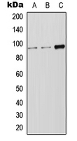 Western blot analysis of LRP12 expression in Jurkat (A); HeLa (B); SP2/0 (C) whole cell lysates.