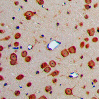Immunohistochemical analysis of Fibulin 4 staining in human brain formalin fixed paraffin embedded tissue section. The section was pre-treated using heat mediated antigen retrieval with sodium citrate buffer (pH 6.0). The section was then incubated with the antibody at room temperature and detected using an HRP conjugated compact polymer system. DAB was used as the chromogen. The section was then counterstained with haematoxylin and mounted with DPX.