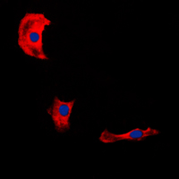Immunofluorescent analysis of Fibulin 4 staining in HepG2 cells. Formalin-fixed cells were permeabilized with 0.1% Triton X-100 in TBS for 5-10 minutes and blocked with 3% BSA-PBS for 30 minutes at room temperature. Cells were probed with the primary antibody in 3% BSA-PBS and incubated overnight at 4 C in a humidified chamber. Cells were washed with PBST and incubated with a DyLight 594-conjugated secondary antibody (red) in PBS at room temperature in the dark. DAPI was used to stain the cell nuclei (blue).