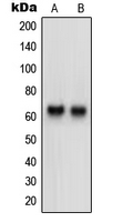 Western blot analysis of Neurotrimin expression in HeLa (A); HepG2 (B) whole cell lysates.
