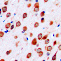 Immunohistochemical analysis of Neurotrimin staining in human brain formalin fixed paraffin embedded tissue section. The section was pre-treated using heat mediated antigen retrieval with sodium citrate buffer (pH 6.0). The section was then incubated with the antibody at room temperature and detected using an HRP conjugated compact polymer system. DAB was used as the chromogen. The section was then counterstained with haematoxylin and mounted with DPX.