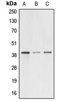 Western blot analysis of A4GNT expression in HEK293T (A); mouse testis (B); rat kidney (C) whole cell lysates.