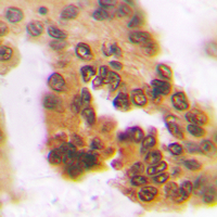 Immunohistochemical analysis of A4GNT staining in human pancreas formalin fixed paraffin embedded tissue section. The section was pre-treated using heat mediated antigen retrieval with sodium citrate buffer (pH 6.0). The section was then incubated with the antibody at room temperature and detected using an HRP conjugated compact polymer system. DAB was used as the chromogen. The section was then counterstained with haematoxylin and mounted with DPX.