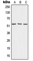 Western blot analysis of Angiopoietin-4 expression in HEK293T (A); mouse lung (B); PC12 (C) whole cell lysates.