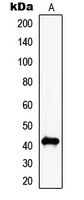 Western blot analysis of MAGEC2 expression in NIH3T3 (A) whole cell lysates.