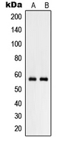 Western blot analysis of RHCG expression in NCIH460 (A); human testis (B) whole cell lysates.