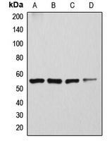 Western blot analysis of ATP6V1H expression in Caki1 (A); SKNSH (B); rat kidney (C); mouse brain (D) whole cell lysates.