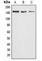 Western blot analysis of ARID4B expression in HeLa (A); MCF7 (B); rat lung (C) whole cell lysates.