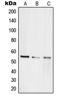 Western blot analysis of RAP1A expression in HEK293T (A); HeLa (B); PC12 (C) whole cell lysates.