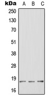 Western blot analysis of HES2 expression in HeLa (A); mouse brain (B); rat brain (C) whole cell lysates.