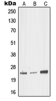 Western blot analysis of MED18 expression in HEK293T (A); mouse brain (B); rat kidney (C) whole cell lysates.