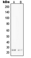Western blot analysis of PPP1R14D expression in Jurkat (A); HepG2 (B) whole cell lysates.