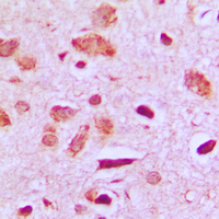 Immunohistochemical analysis of PPP1R14D staining in human brain formalin fixed paraffin embedded tissue section. The section was pre-treated using heat mediated antigen retrieval with sodium citrate buffer (pH 6.0). The section was then incubated with the antibody at room temperature and detected using an HRP conjugated compact polymer system. DAB was used as the chromogen. The section was then counterstained with haematoxylin and mounted with DPX.