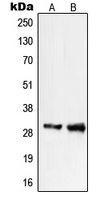 Western blot analysis of PIGX expression in COLO205 (A); WI38 (B) whole cell lysates.
