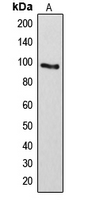 Western blot analysis of ARHGAP17 expression in Lovo (A) whole cell lysates.