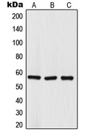 Western blot analysis of TRIM68 expression in HepG2 (A); DU145 (B); NCIH460 (C) whole cell lysates.